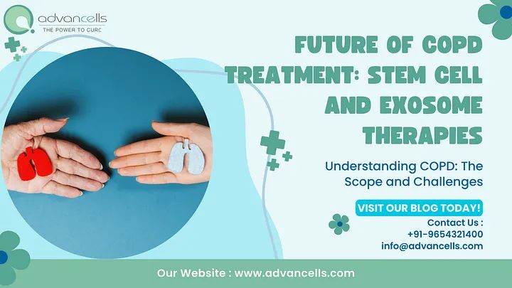 Stem Cell Treatment for COPD